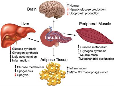 Metabolic Health, Insulin, and Breast Cancer: Why Oncologists Should Care About Insulin